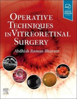 Operative Techniques in Vitreoretinal Surgery (Original PDF from Publisher)