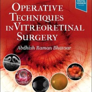 Operative Techniques in Vitreoretinal Surgery (Original PDF from Publisher)