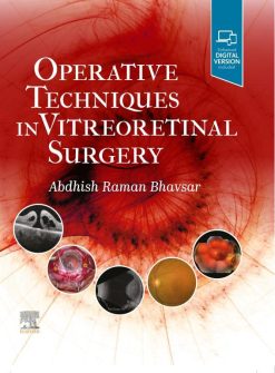 Operative Techniques in Vitreoretinal Surgery (EPUB)
