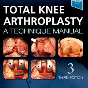 Total Knee Arthroplasty: A Technique Manual, 3rd Edition (EPUB)