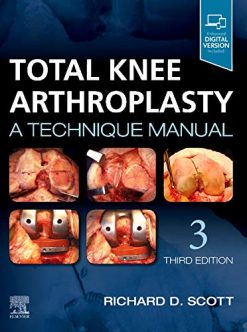 Total Knee Arthroplasty: A Technique Manual, 3rd edition (True PDF)