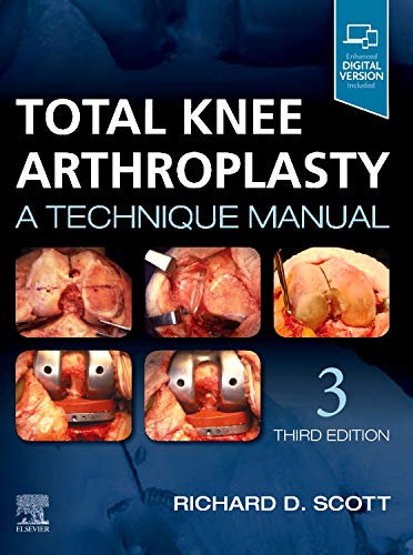 Total Knee Arthroplasty: A Technique Manual, 3rd edition (True PDF)