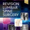 Revision Lumbar Spine Surgery (Original PDF from Publisher)