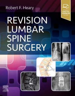 Revision Lumbar Spine Surgery (Original PDF from Publisher)
