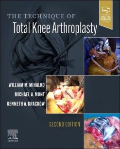 The Technique of Total Knee Arthroplasty, 2nd edition (Original PDF from Publisher)