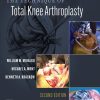 The Technique of Total Knee Arthroplasty, 2nd Edition (EPUB)