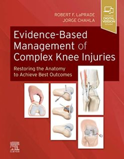 Evidence-Based Management of Complex Knee Injuries: Restoring the Anatomy to Achieve Best Outcomes (True PDF)