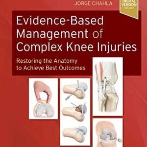 Evidence-Based Management of Complex Knee Injuries: Restoring the Anatomy to Achieve Best Outcomes (True PDF)