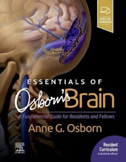 Essentials of Osborn’s Brain: A Fundamental Guide for Residents and Fellows (EPUB)