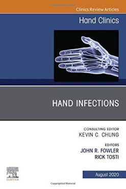 Hand Infections, An Issue of Hand Clinics (Volume 36-3) (The Clinics: Orthopedics, Volume 36-3) (Original PDF from Publisher)