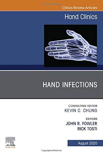 Hand Infections, An Issue of Hand Clinics (Volume 36-3) (The Clinics: Orthopedics, Volume 36-3) (Original PDF from Publisher)
