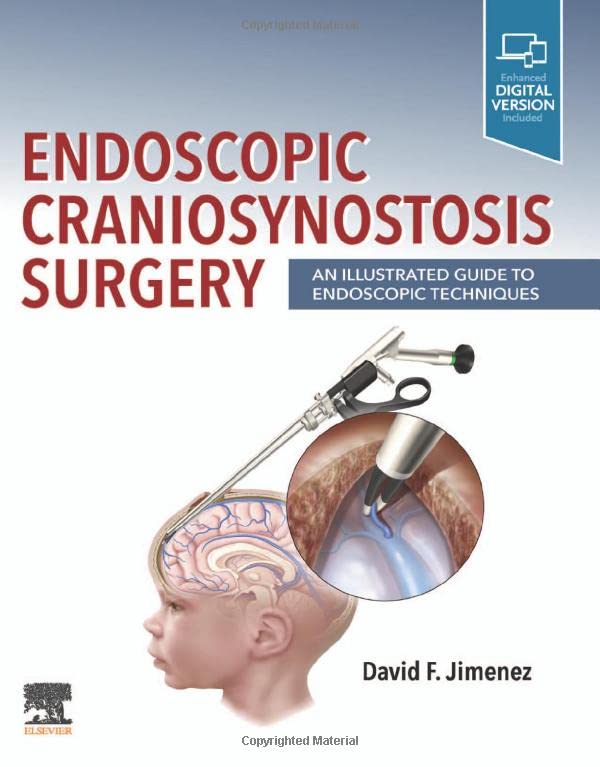 Endoscopic Craniosynostosis Surgery: An Illustrated Guide to Endoscopic Techniques (True PDF)