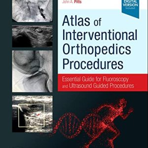 Atlas of Interventional Orthopedics Procedures: Essential Guide for Fluoroscopy and Ultrasound Guided Procedures (Original PDF from Publisher)