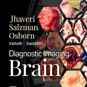 Diagnostic Imaging: Brain, 4th Edition (Original PDF from Publisher)