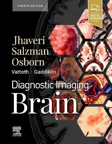Diagnostic Imaging: Brain, 4th Edition (Original PDF from Publisher)