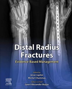 Distal Radius Fractures: Evidence-Based Management (True PDF+ToC+Index+Videos)