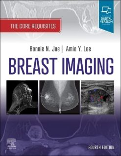 Breast Imaging: The Core Requisites, 4th edition (Original PDF from Publisher)