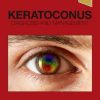 Keratoconus: Diagnosis and Management (Original PDF from Publisher)