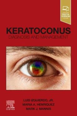 Keratoconus: Diagnosis and Management (Original PDF from Publisher)