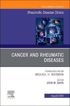 Cancer and Rheumatic Diseases, An Issue of Rheumatic Disease Clinics of North America (Volume 46-3) (The Clinics: Internal Medicine, Volume 46-3) (Original PDF from Publisher)