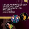 Nuclear Cardiology and Multimodal Cardiovascular Imaging: A Companion to Braunwald’s Heart Disease (Original PDF from Publisher)