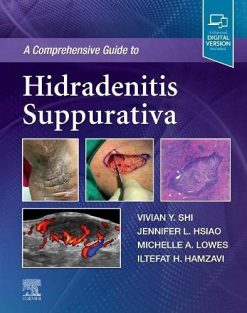 A Comprehensive Guide to Hidradenitis Suppurativa (Original PDF from Publisher)