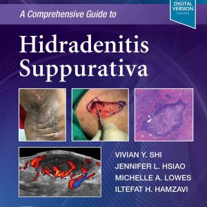 A Comprehensive Guide to Hidradenitis Suppurativa (EPUB)