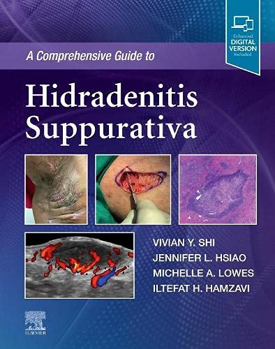 A Comprehensive Guide to Hidradenitis Suppurativa (Original PDF from Publisher)