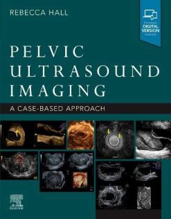 Pelvic Ultrasound Imaging: A Cased-Based Approach (Original PDF from Publisher+Videos)