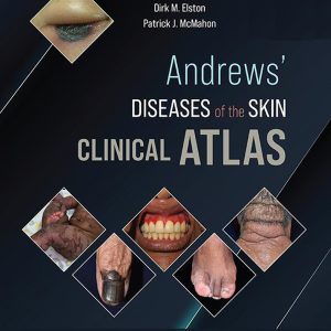 Andrews’ Diseases of the Skin Clinical Atlas, 2nd Edition (EPUB)