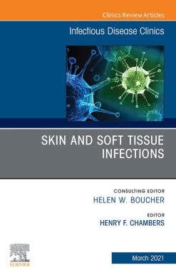 Skin and Soft Tissue Infections, An Issue of Infectious Disease Clinics of North America (EPUB)