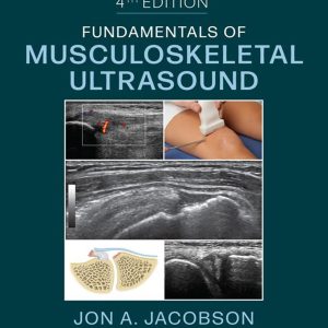 Fundamentals of Musculoskeletal Ultrasound, 4th Edition (EPUB)
