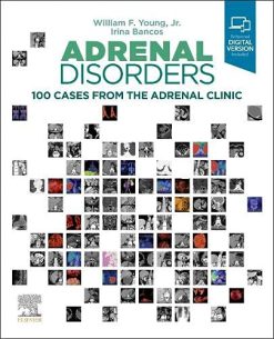 Adrenal Disorders: 100 Cases from the Adrenal Clinic (Original PDF from Publisher)