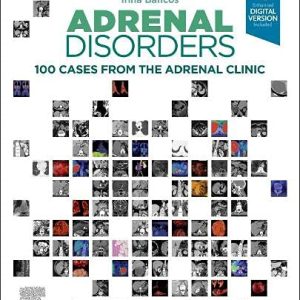 Adrenal Disorders: 100 Cases from the Adrenal Clinic (Original PDF from Publisher)