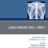 Lung Cancer 2021, Part 1, An Issue of Thoracic Surgery Clinics (Original PDF from Publisher)