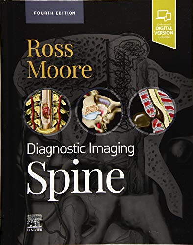 Diagnostic Imaging: Spine, 4th Edition (Original PDF from Publisher)