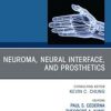 Neuroma, Neural interface, and Prosthetics, An Issue of Hand Clinics (Original PDF from Publisher)