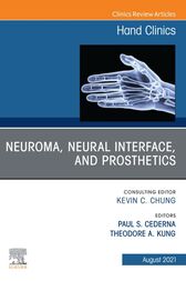 Neuroma, Neural interface, and Prosthetics, An Issue of Hand Clinics (Original PDF from Publisher)