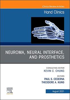 Neuroma, Neural interface, and Prosthetics, An Issue of Hand Clinics (Volume 37-3) (The Clinics: Orthopedics, Volume 37-3) (Original PDF from Publisher)