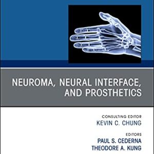 Neuroma, Neural interface, and Prosthetics, An Issue of Hand Clinics (Volume 37-3) (The Clinics: Orthopedics, Volume 37-3) (Original PDF from Publisher)