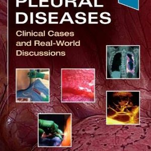 Pleural Diseases: Clinical Cases and Real-World Discussions (Original PDF from Publisher)