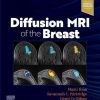 Diffusion MRI of the Breast (Original PDF from Publisher)