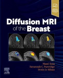 Diffusion MRI of the Breast (Original PDF from Publisher)