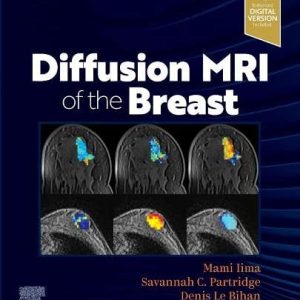 Diffusion MRI of the Breast (Original PDF from Publisher)