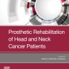 Prosthetic Rehabilitation of Head and Neck Cancer Patients (EPUB)