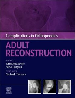 Complications in Orthopaedics: Adult Reconstruction (Original PDF from Publisher)