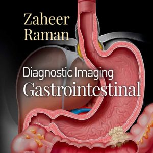 Diagnostic Imaging: Gastrointestinal, 4th Edition (EPUB)