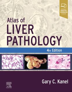 Atlas of Liver Pathology, 4th Edition (EPUB)