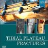 Tibial Plateau Fractures (EPUB + Converted PDF)