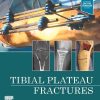 Tibial Plateau Fractures (Original PDF from Publisher)